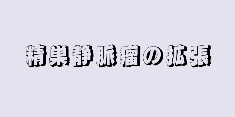 精巣静脈瘤の拡張