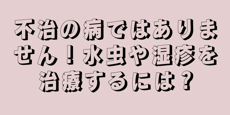 不治の病ではありません！水虫や湿疹を治療するには？