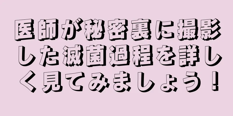医師が秘密裏に撮影した滅菌過程を詳しく見てみましょう！